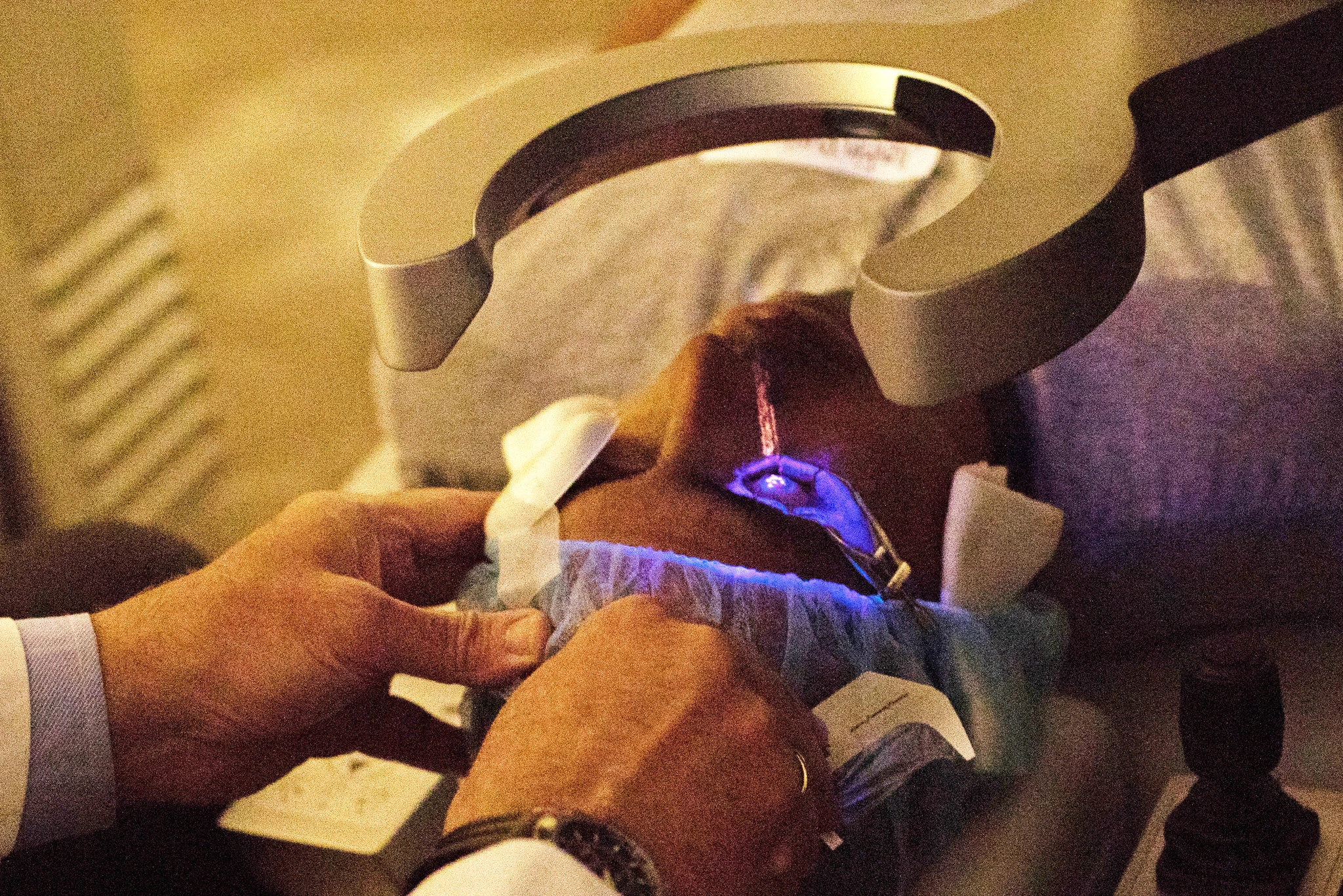 贾斯汀·普格里西（Justin Puglisi）正在纽约加登市区接受激光近视手术，这项 15 分钟左右即可完成的手术，去年进行了 70 万次